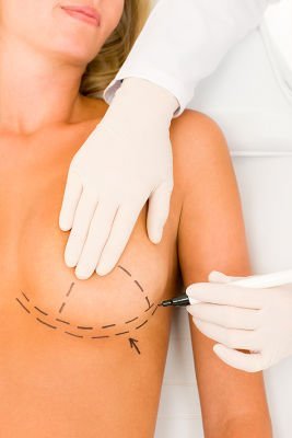 About Otoplasty