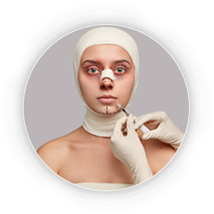 Rhinoplasty